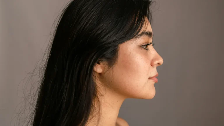 Profile portrait of a young woman with natural skin, used in a c1 lesson about beauty and plastic surgery discussion activity.